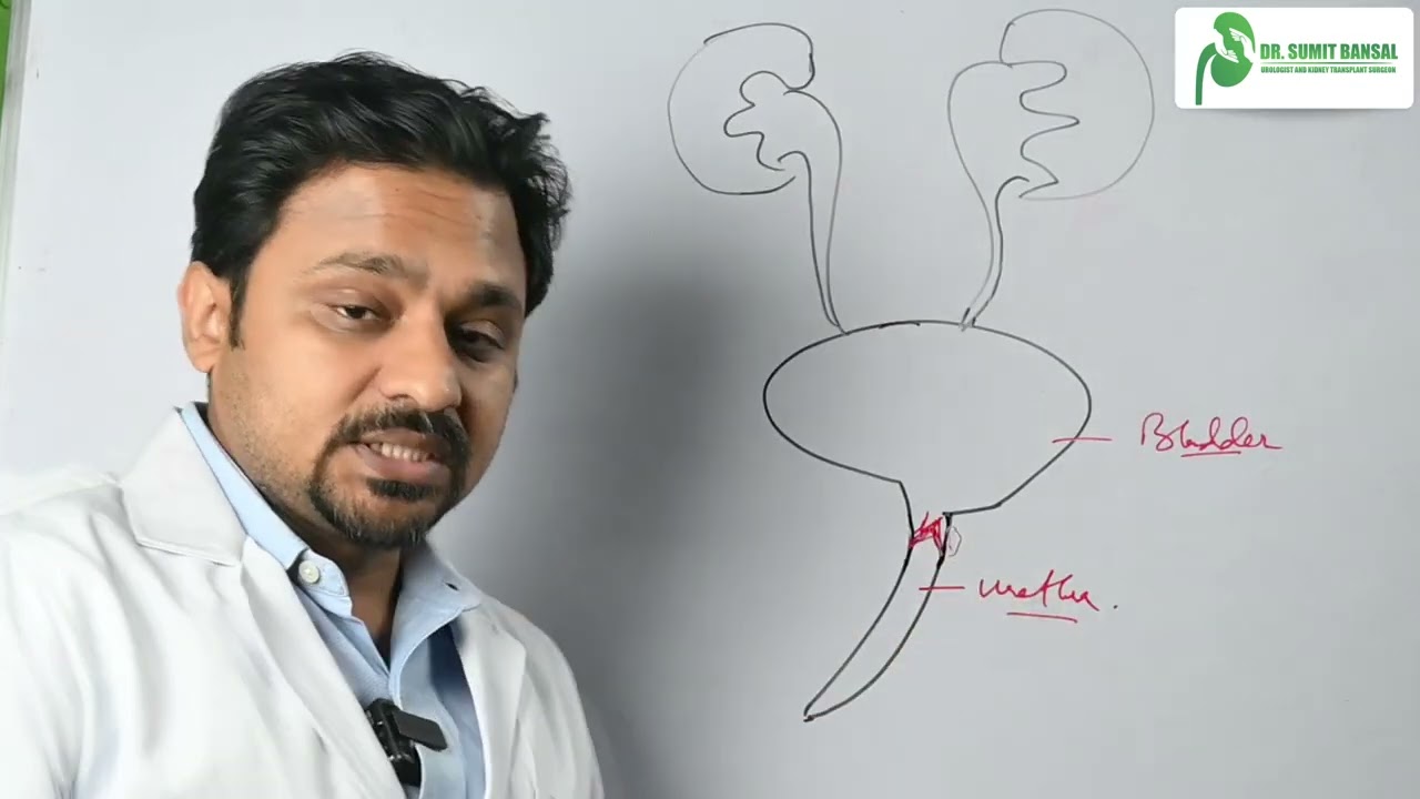 Posterior Urethra Valves(PUV) - By Dr.  Sumit Bansal