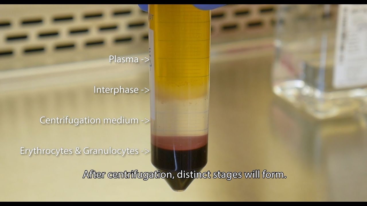 Isolate PBMCs with Lymphopure™