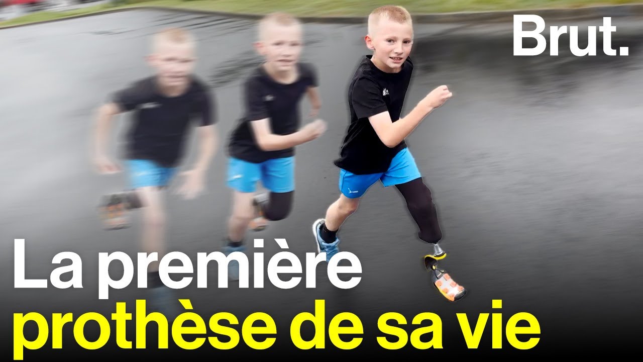 Enzo, 9 ans, amputé, découvre sa prothèse pour la première fois.