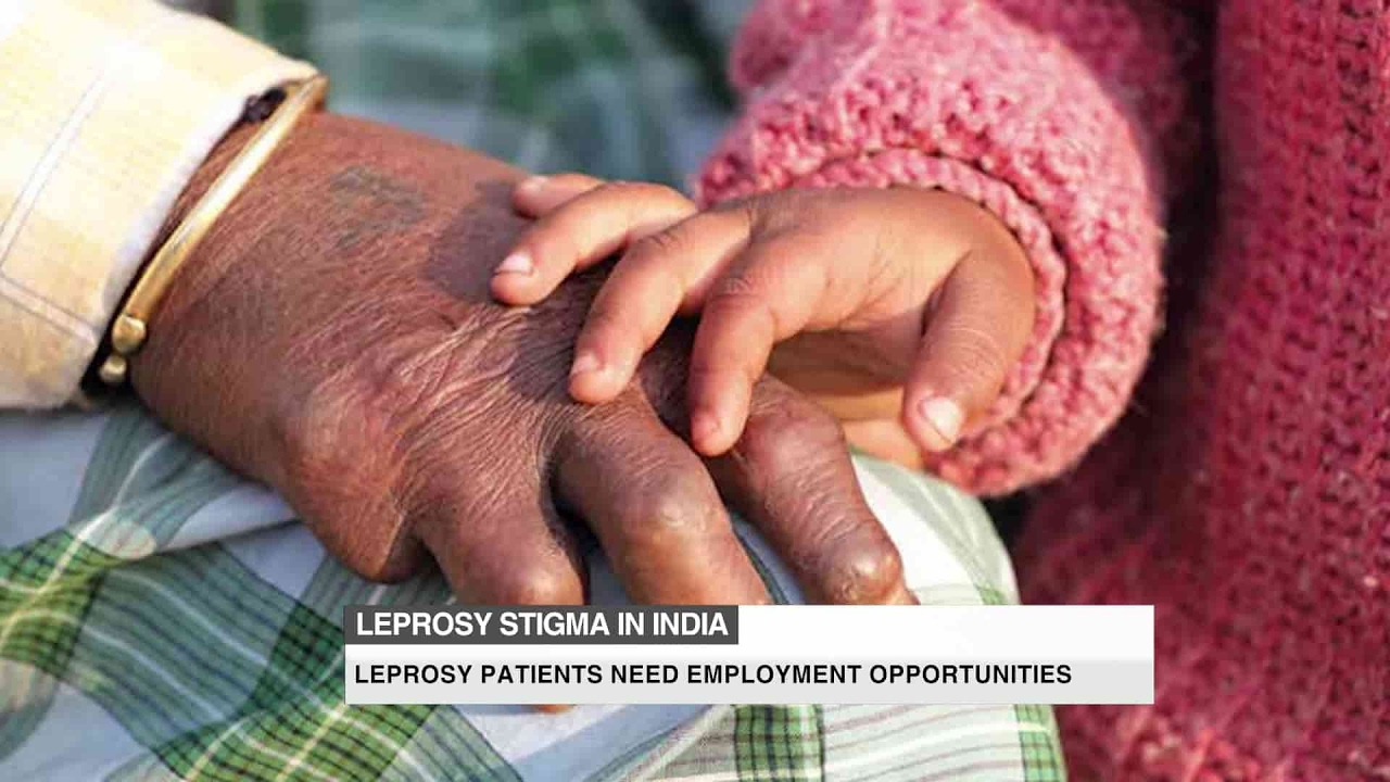 The stigma of leprosy in India
