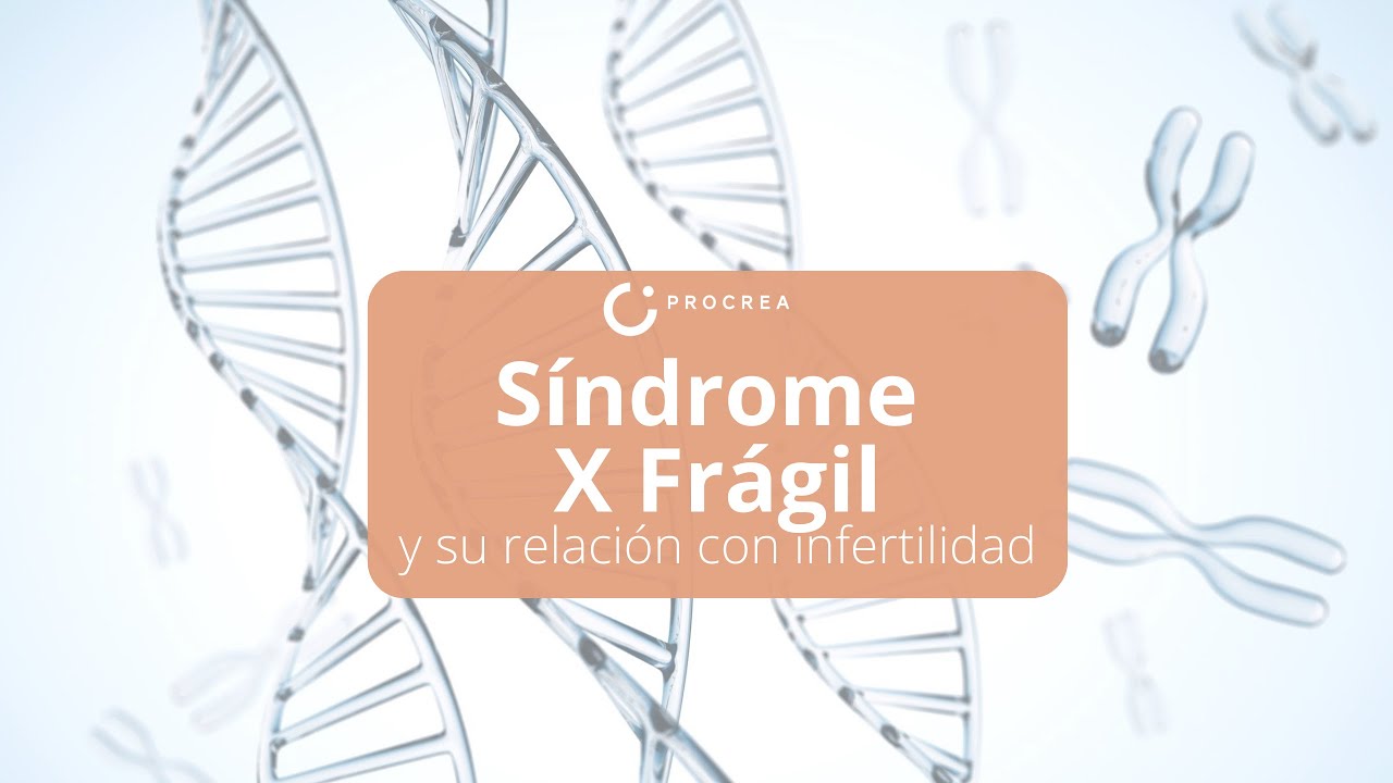 Síndrome X frágil e infertilidad