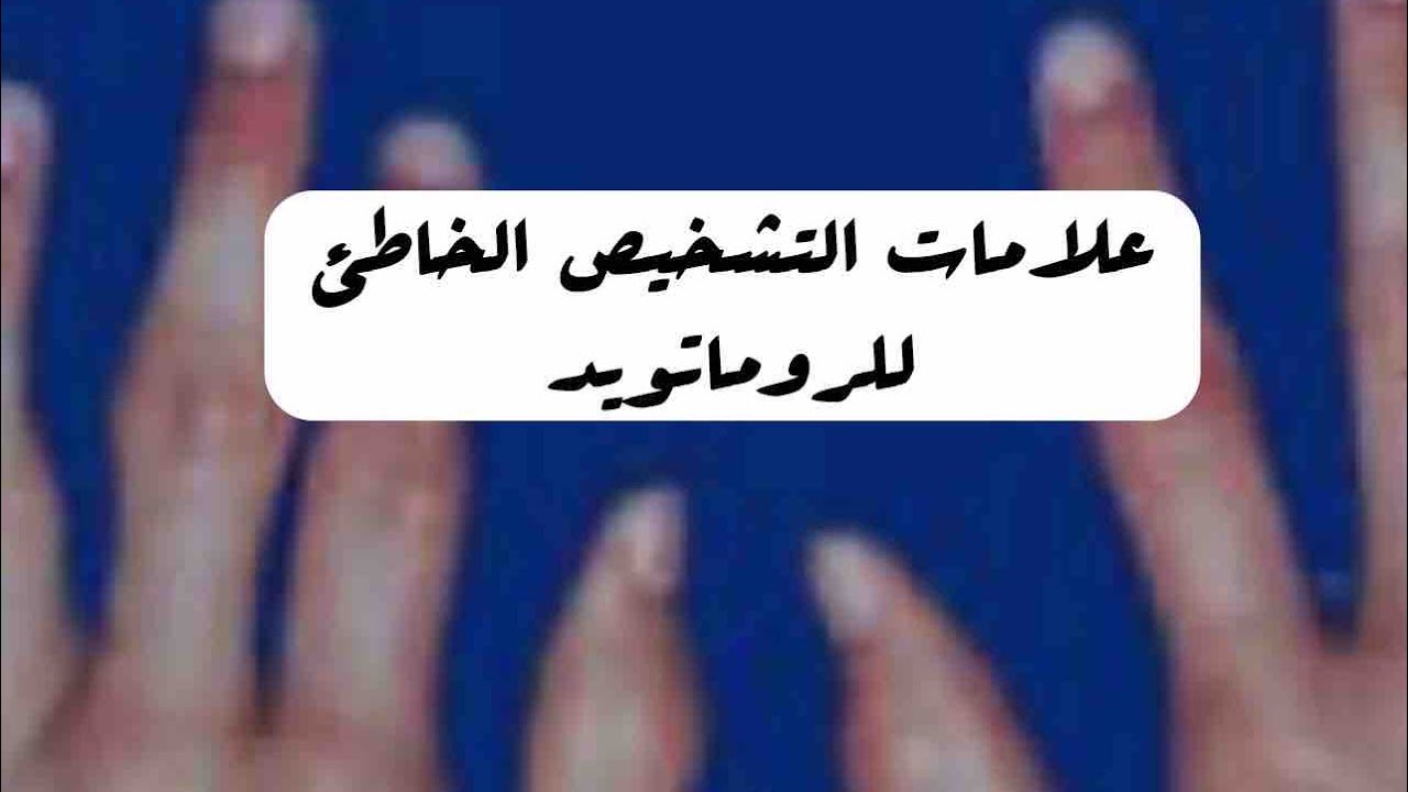 علامات تدل على تشخيص الروماتويد الخاطئ