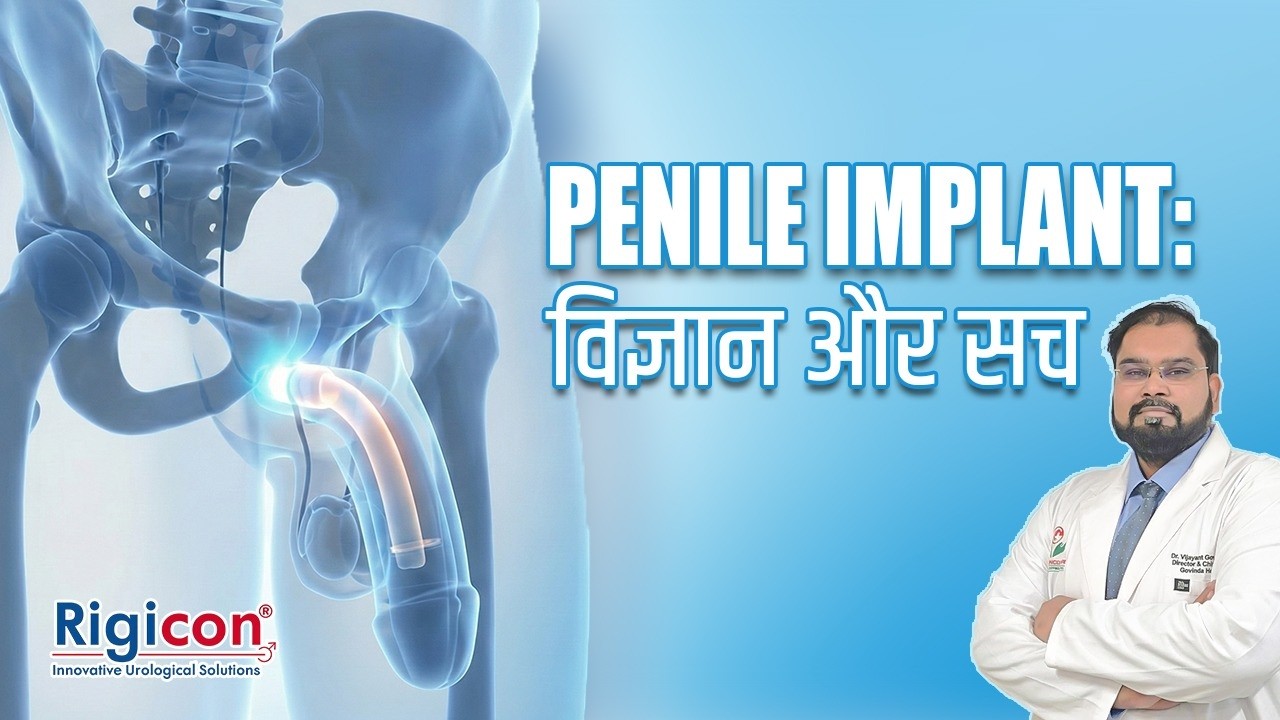 क्या Penile Implant बेस्ट है? | Erectile Dysfunction का Permanent Solution | Dr. Vijayant Gupta