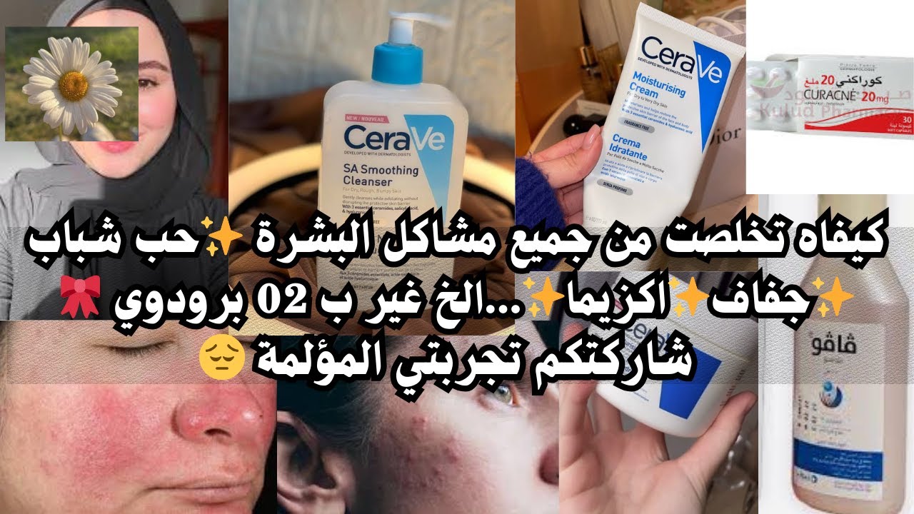 سلسلة جهاز العروسة 🎀 شاركت معاكم تجربتي في التخلص من حب شباب😔أفضل جال نيتوايو لي خلا بشرتي صافية ✨