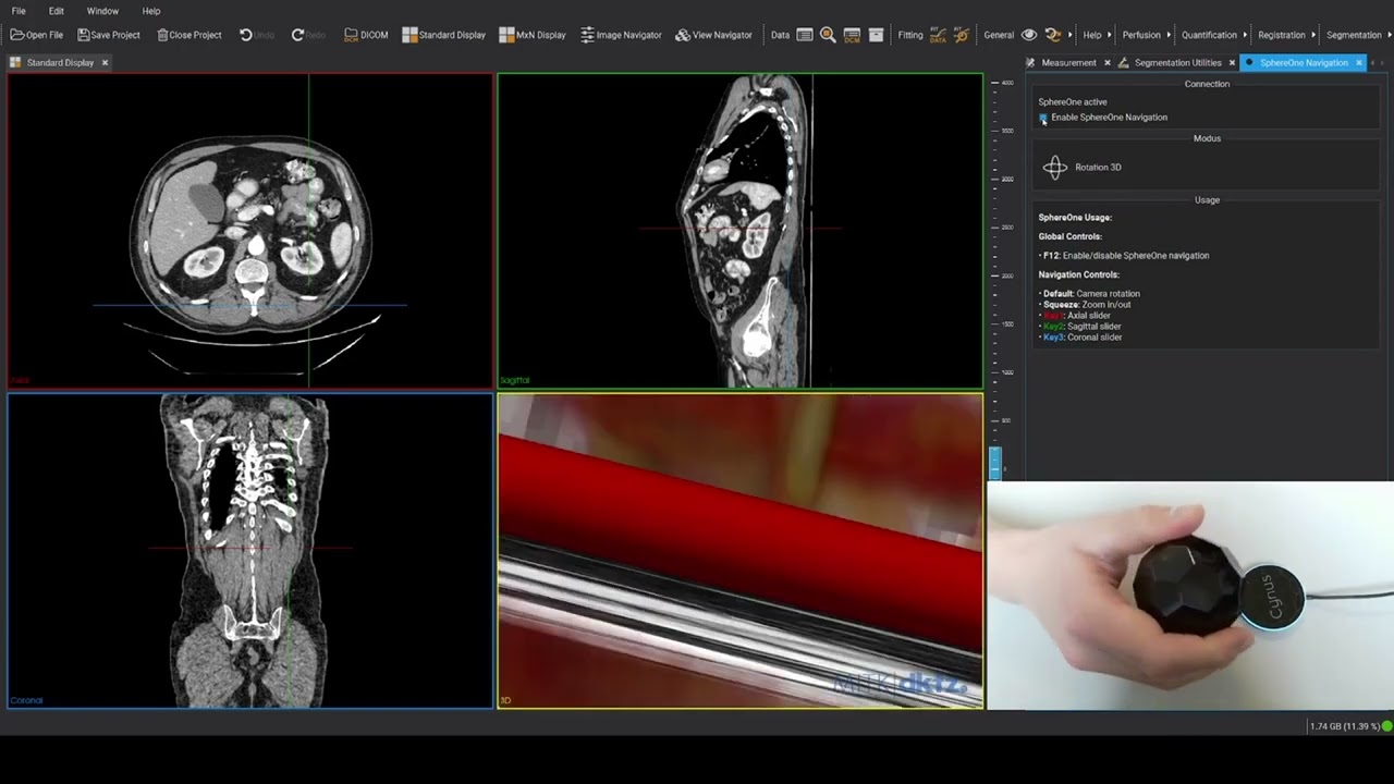 Revolution&auml;re 3D-Navigation im MITK DICOM Viewer &ndash; gesteuert mit Cynus SphereOne (2026)