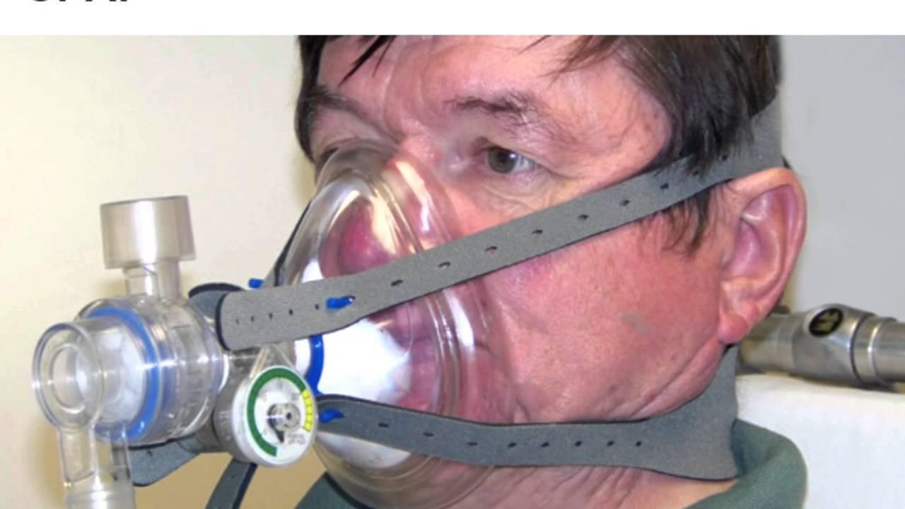 Acute Respiratory Distress Syndrome Overview