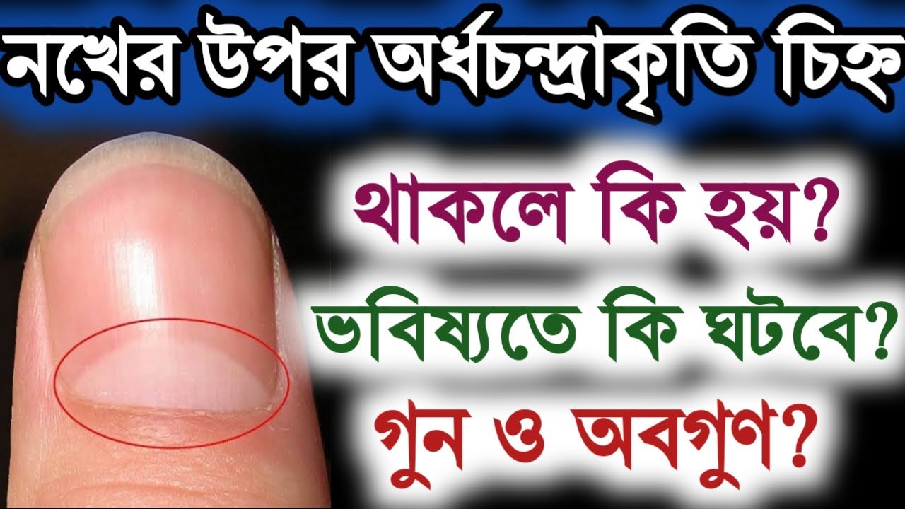 নখের উপর অর্ধচন্দ্রাকৃতি চিহ্ন থাকলে কি হয়, ভবিষ্যতে কি ঘটবে আপনার | সামুদ্রিক শাস্ত্র