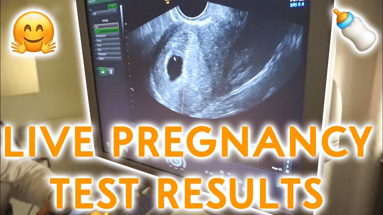 LIVE PREGNANCY TEST!!! TTC JOURNEY (PART 2)