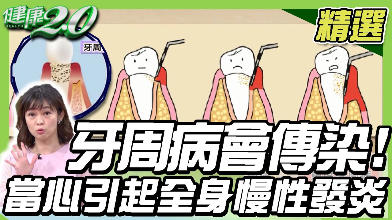 牙周病會傳染！當心會引起全身慢性發炎？牽一齒動全身 傷身又傷財【健康2.0精選】