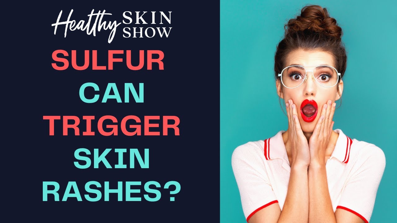 How SULFUR Can Trigger Skin Rashes | Christa Biegler