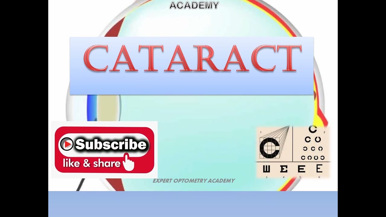 MCQ's on Cataract|MCQ's for Ophthalmic technician Optometrist Jr. Ophthalmic assistant|Ophthalmology