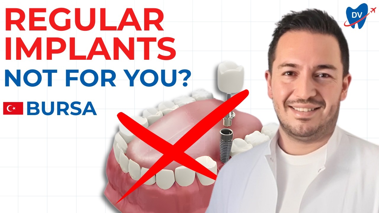 See if Zygomatic Implants in Bursa Are the Key to Your Smile!
