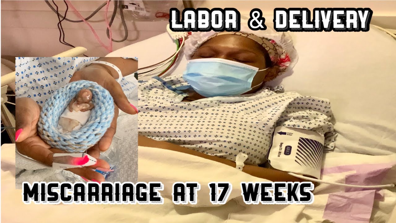 Labor and Delivery | MISCARRIAGE at 17 weeks Pregnant | D&C Surgery