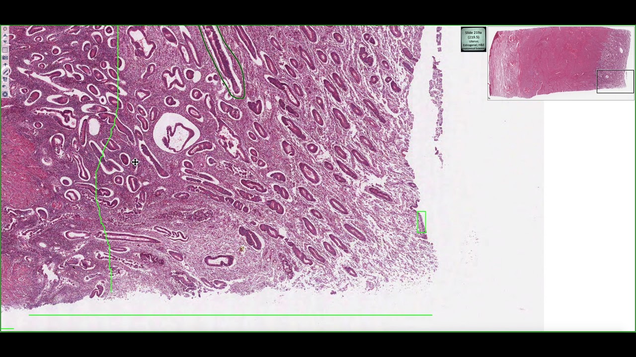 Histology of the Uterus 4K