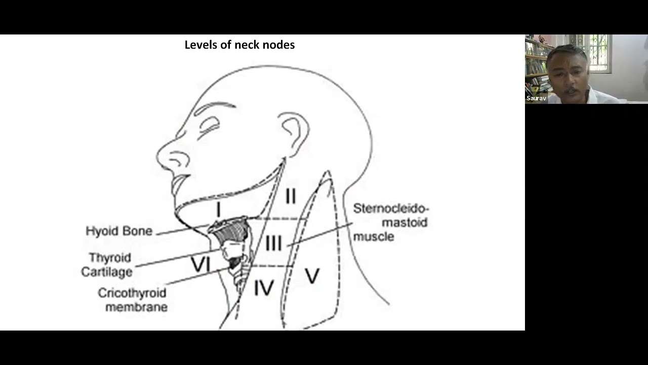 Faculty Lecture by Prof. Saurabh Ghosh: Neck Dissection in Head & Neck Cancers (07.05.22)