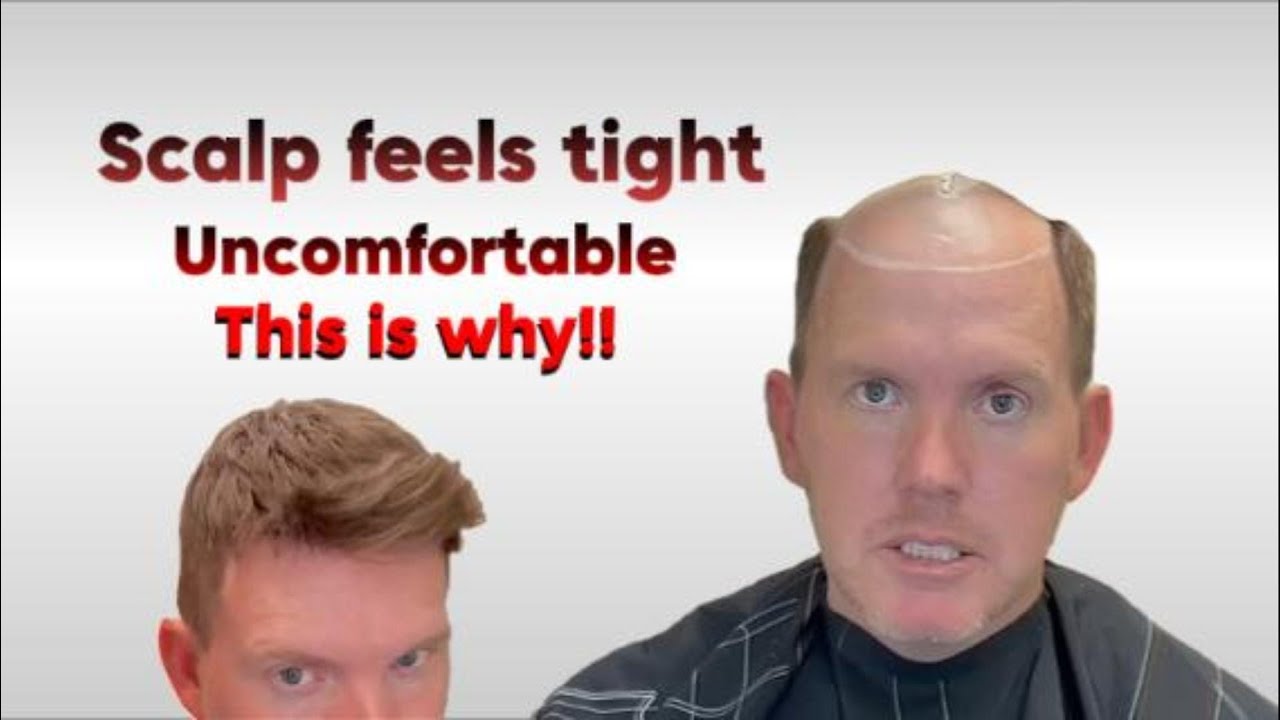 Healthy Scalp, Confident Look: Zeo-Mirage, the game changer.| LaVivid Hair System