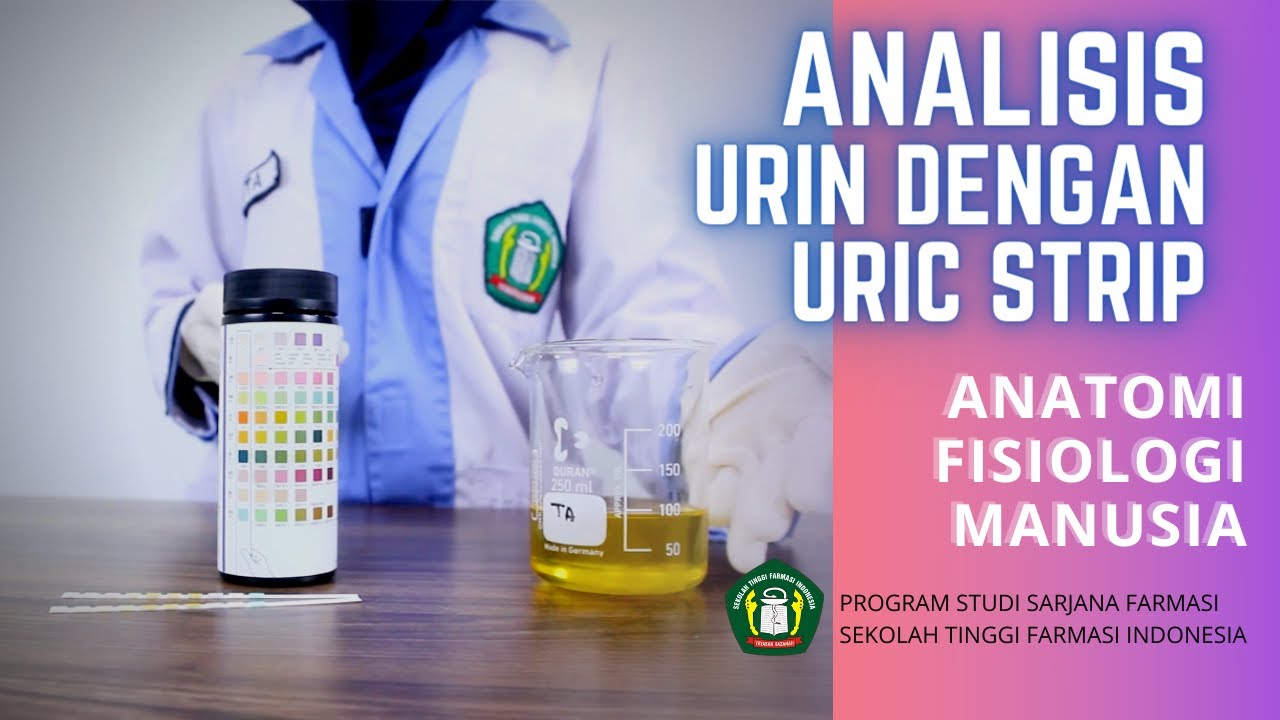ANALISIS URIN DENGAN URIC STRIP | ANFISMAN - STFI Bandung