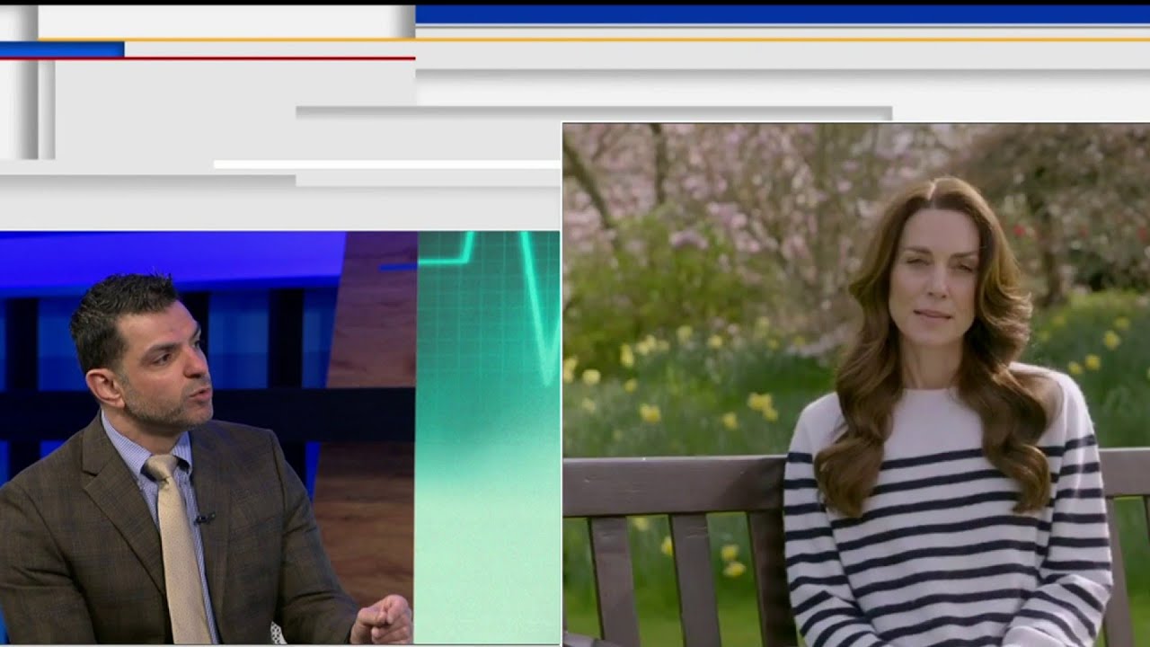 Local cancer expert breaks down Princess Kate's diagnosis