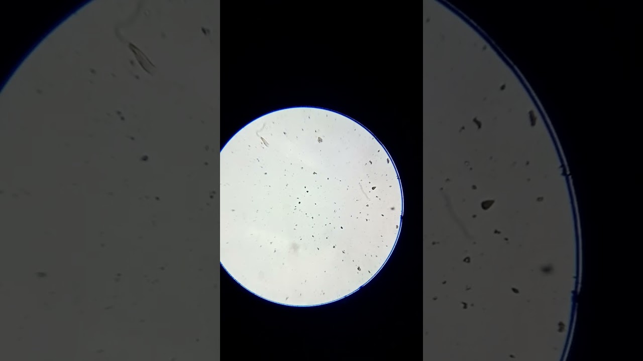 Musgo bajo el microscopio #music#ciencia