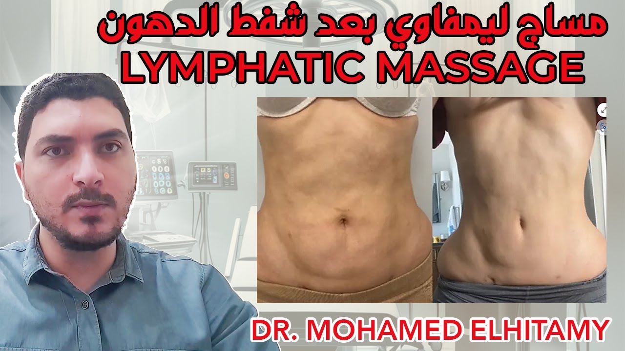 المساج الليمفاوي بعد شفط الدهون | Lymphatic Massage After Liposuction: How, When, & Benefits