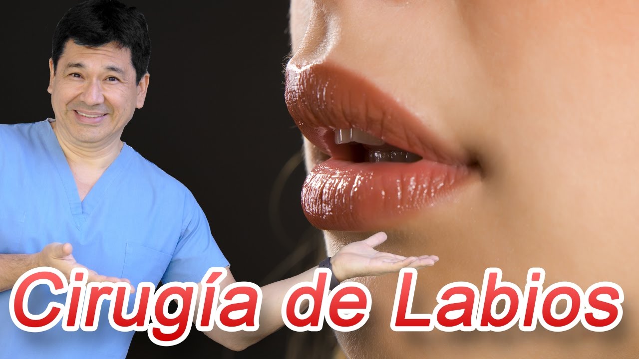 Procedimiento Estético de Labios - ¿Qué es la Queiloplastia?