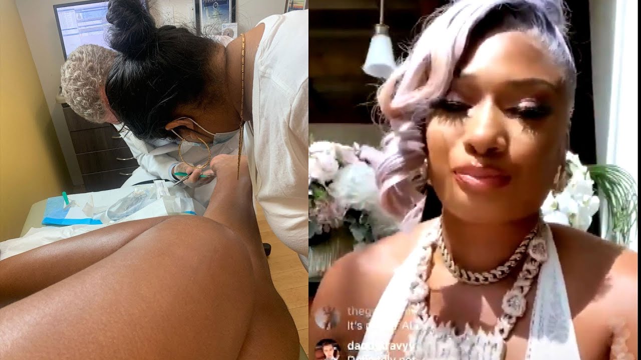 Megan Thee Stallion Injuries From Shooting Incident Were No Joke