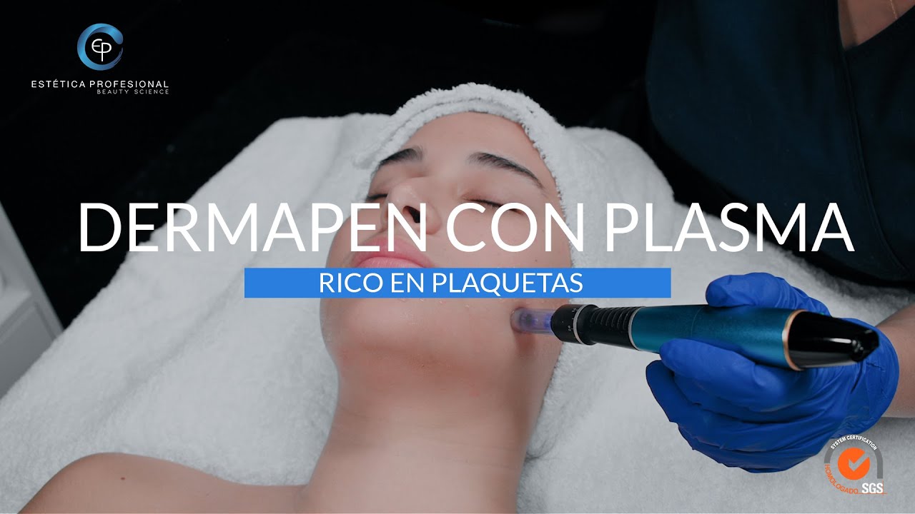 DERMAPEN CON PLASMA RICO EN PLAQUETAS l EP ESTETICA
