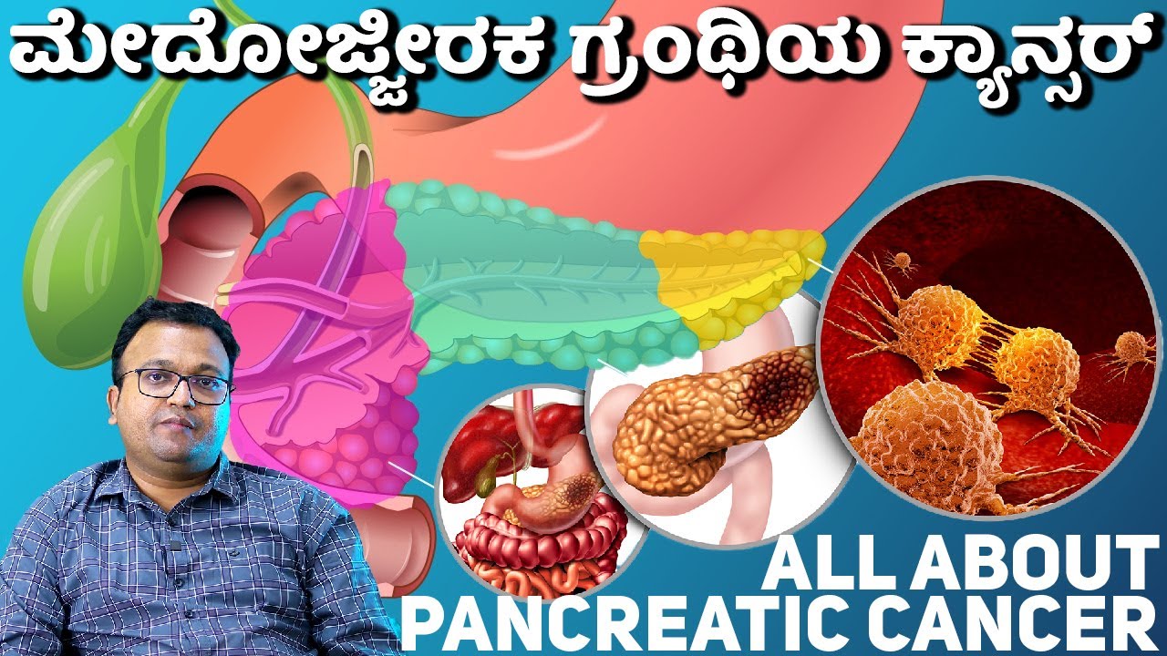 All about pancreatic cancer ಮೇದೋಜ್ಜೀರಕ ಗ್ರಂಥಿಯ ಕ್ಯಾನ್ಸರ್ Dr. Dayananda Srinivasan