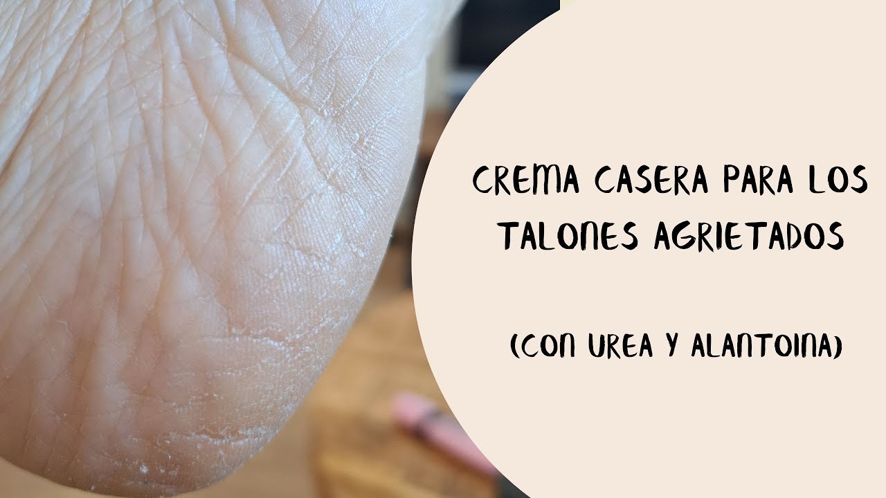Crema casera para los talones agrietados 🦶