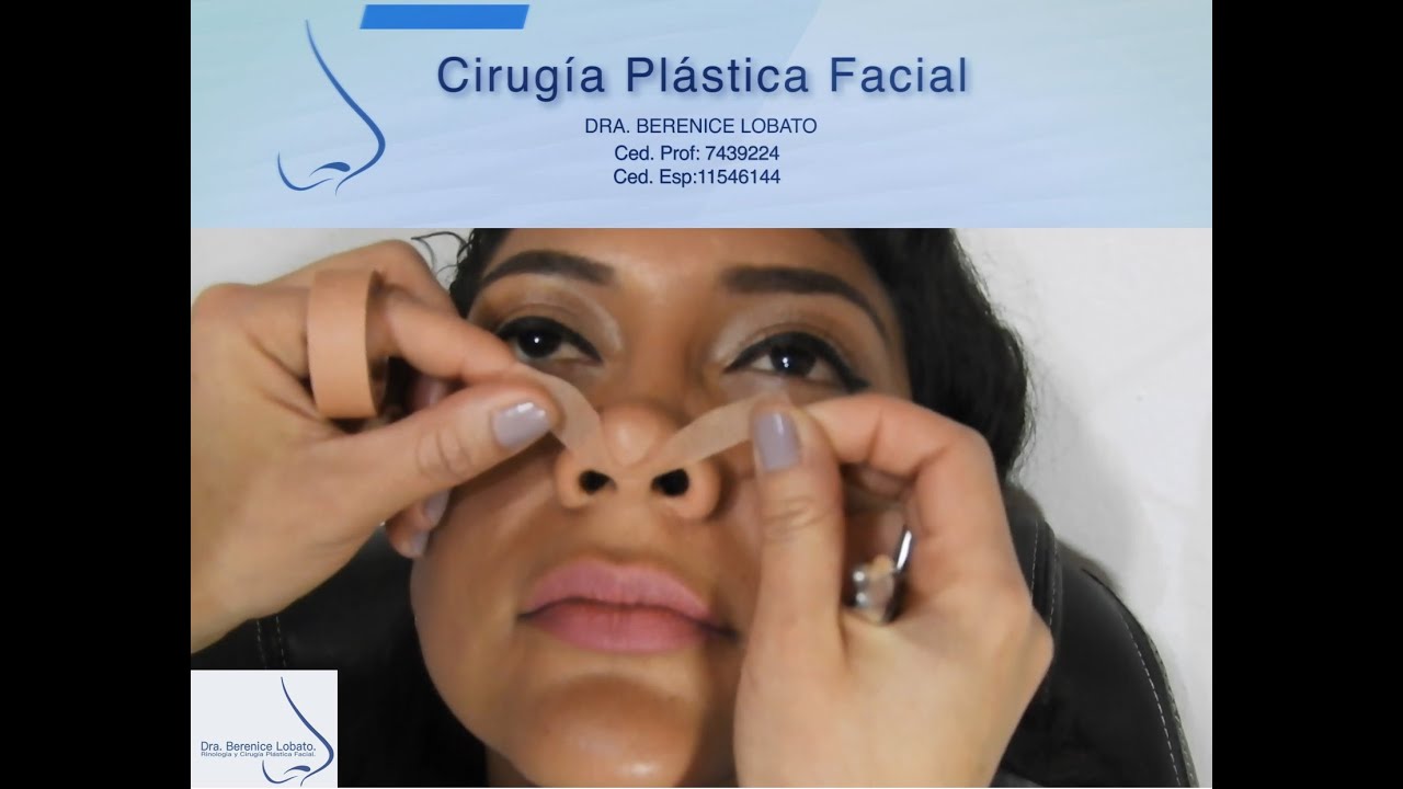 Colocación de Vendaje Nasal