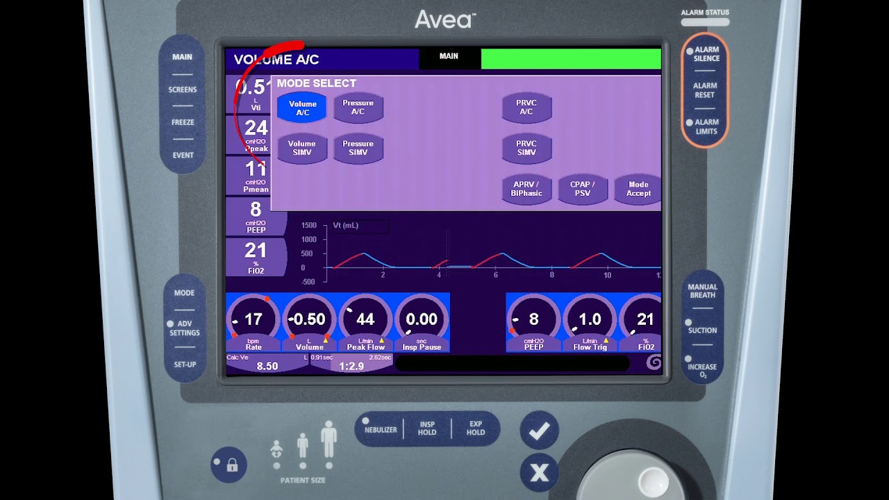 AVEA™ Ventilator: Modes