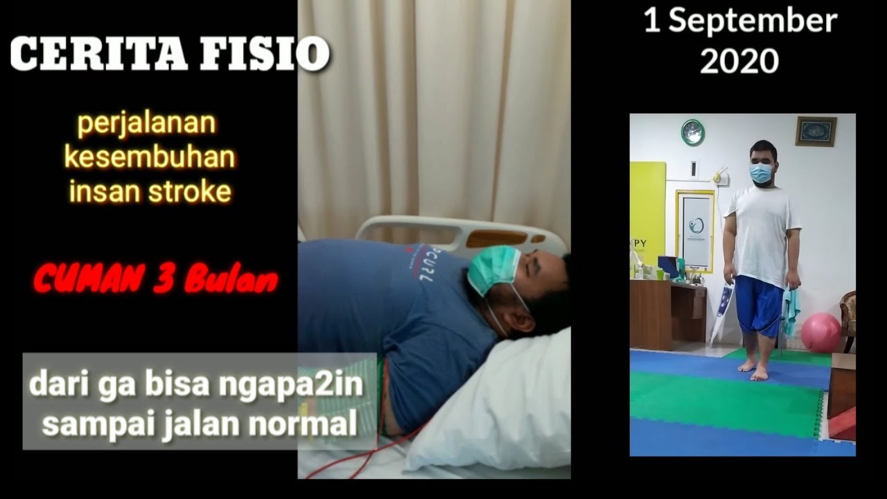 Stroke bisa jalan normal 3bulan dengan Fisioterapi, begini prosesnya