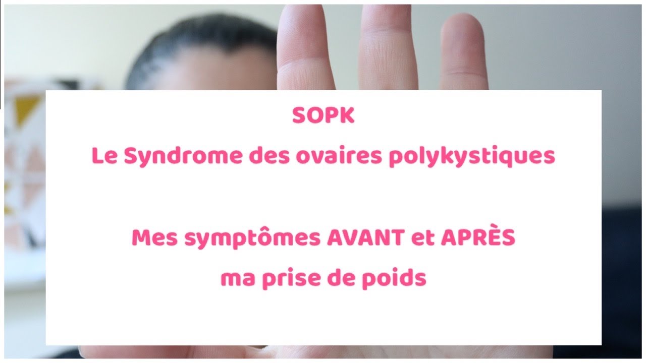 Syndrome des ovaires polykystiques (SOPK) / Mes symptômes AVANT et APRÈS ma prise de poids
