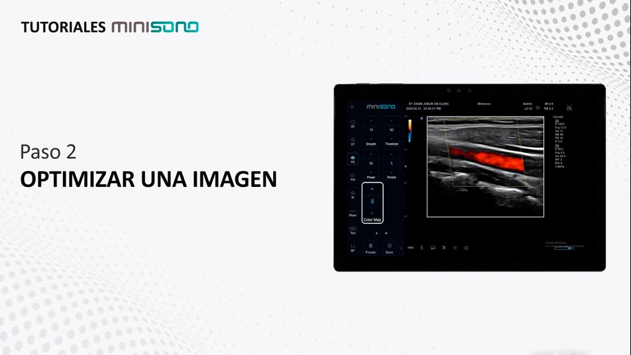 Minisono - Paso 2: Optimizar una Imagen