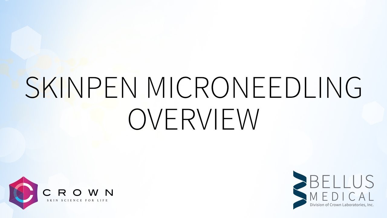 SkinPen Microneedling Overview