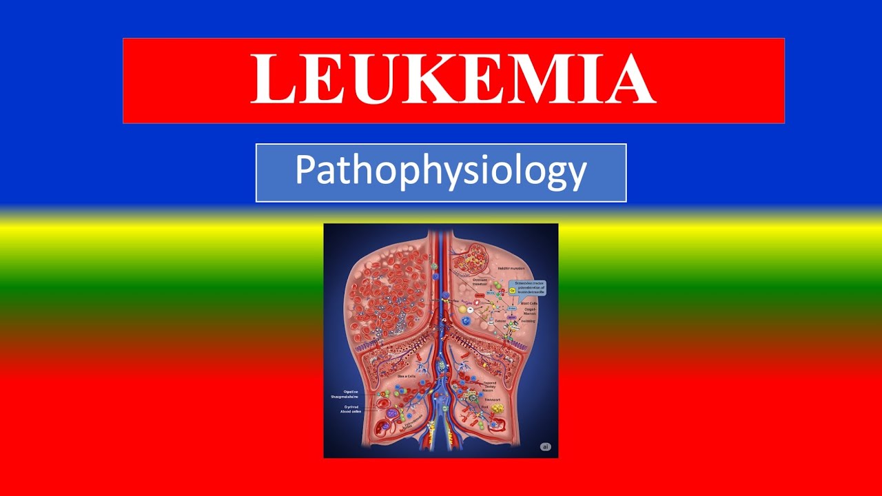 LEUKEMIA - Definition , Pathophysiology step by step process - Explained