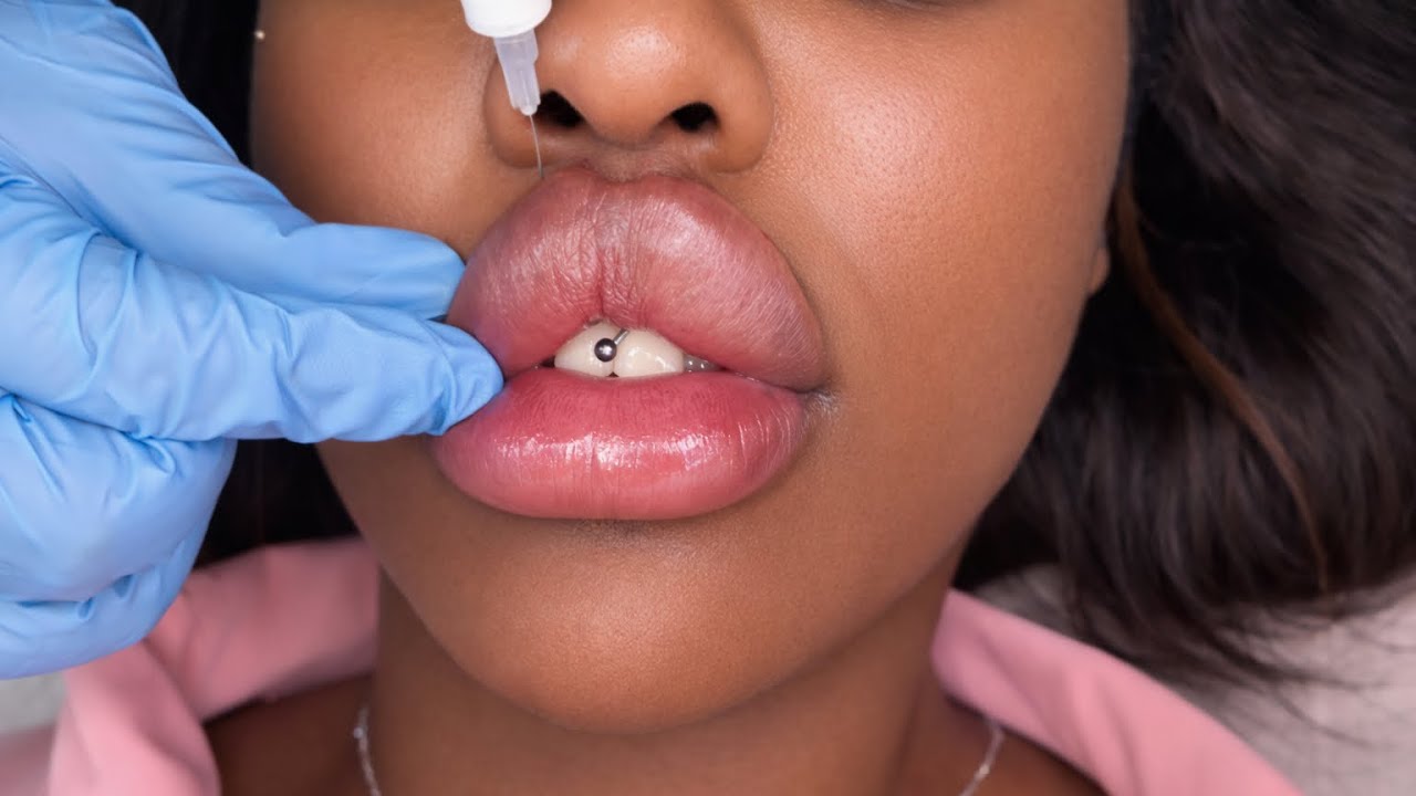  Safe Filler Injection: Step-by-Step Training 2026