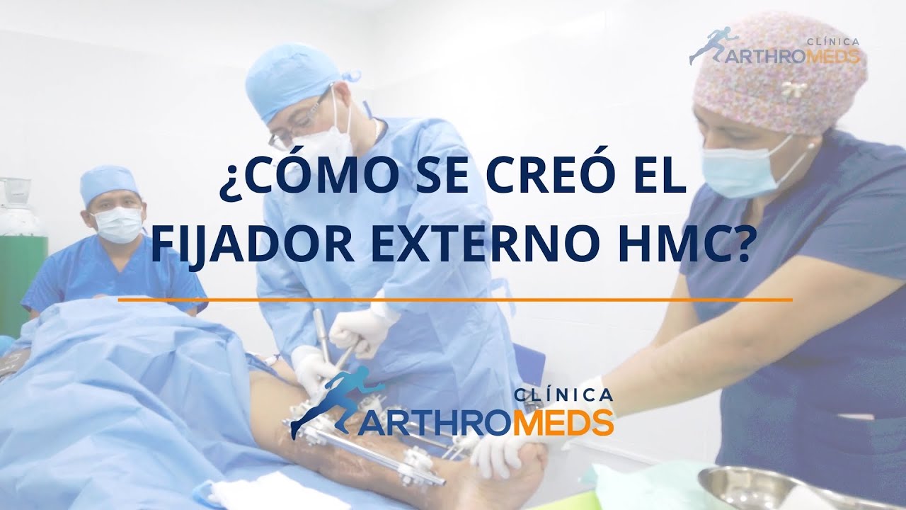 &iquest;C&oacute;mo se cre&oacute; el fijador externo HMC?