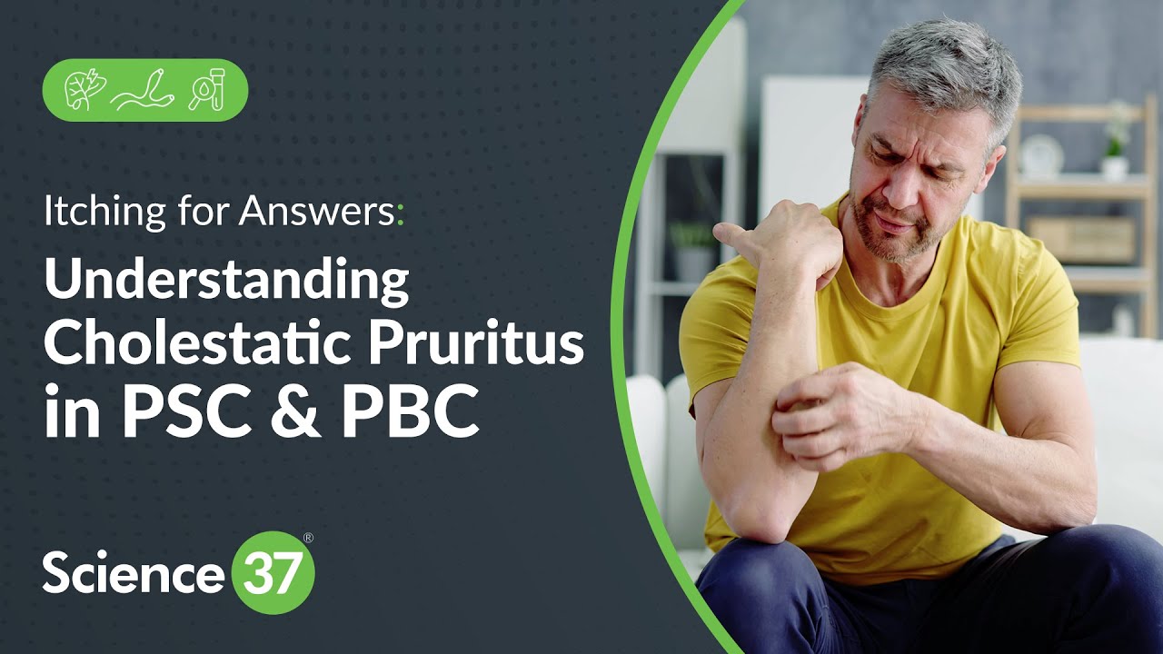 Itching for Answers: Understanding Cholestatic Pruritus in PSC and PBC | Science 37