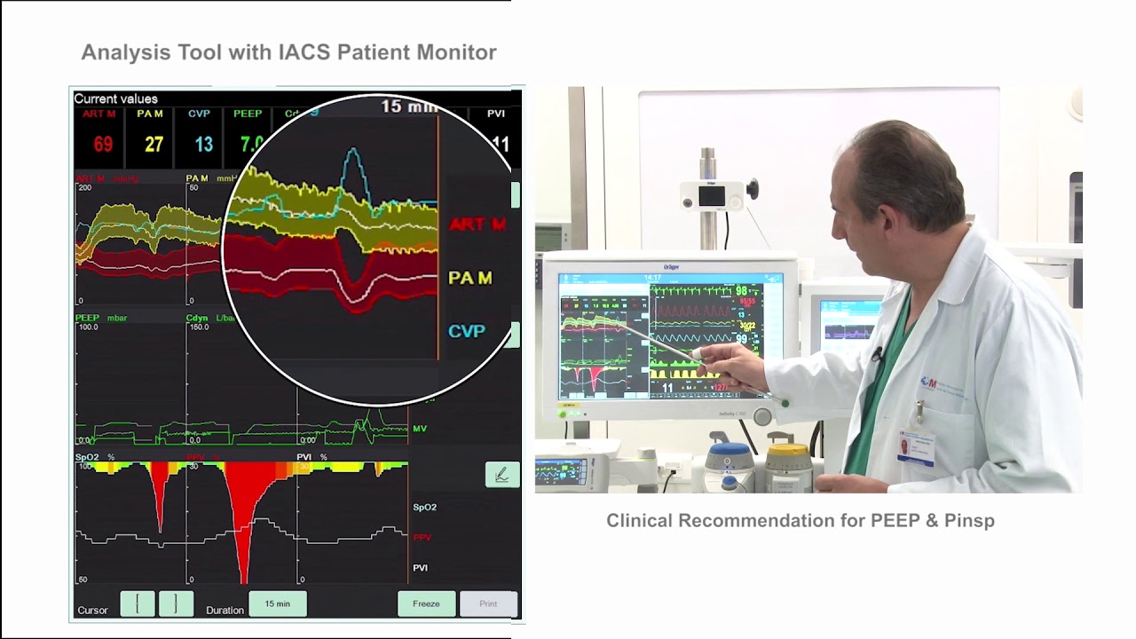 What are the hemodynamic effects of lung recruitment manoeuvres?