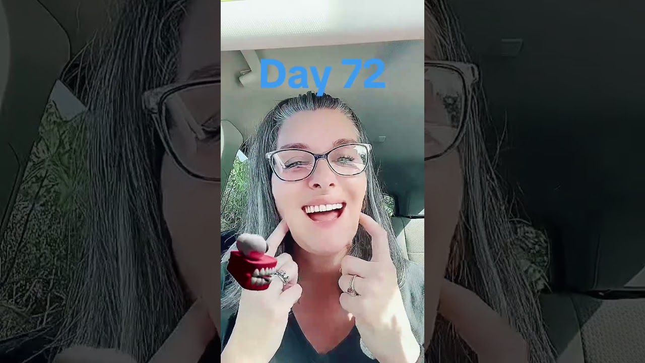 Day 72 of my denture journey 