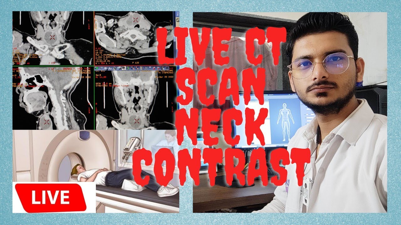 CT SCAN NECK Contrast scanning process|| CECT NECK scanning technique #radiologytechnologist #ctscan