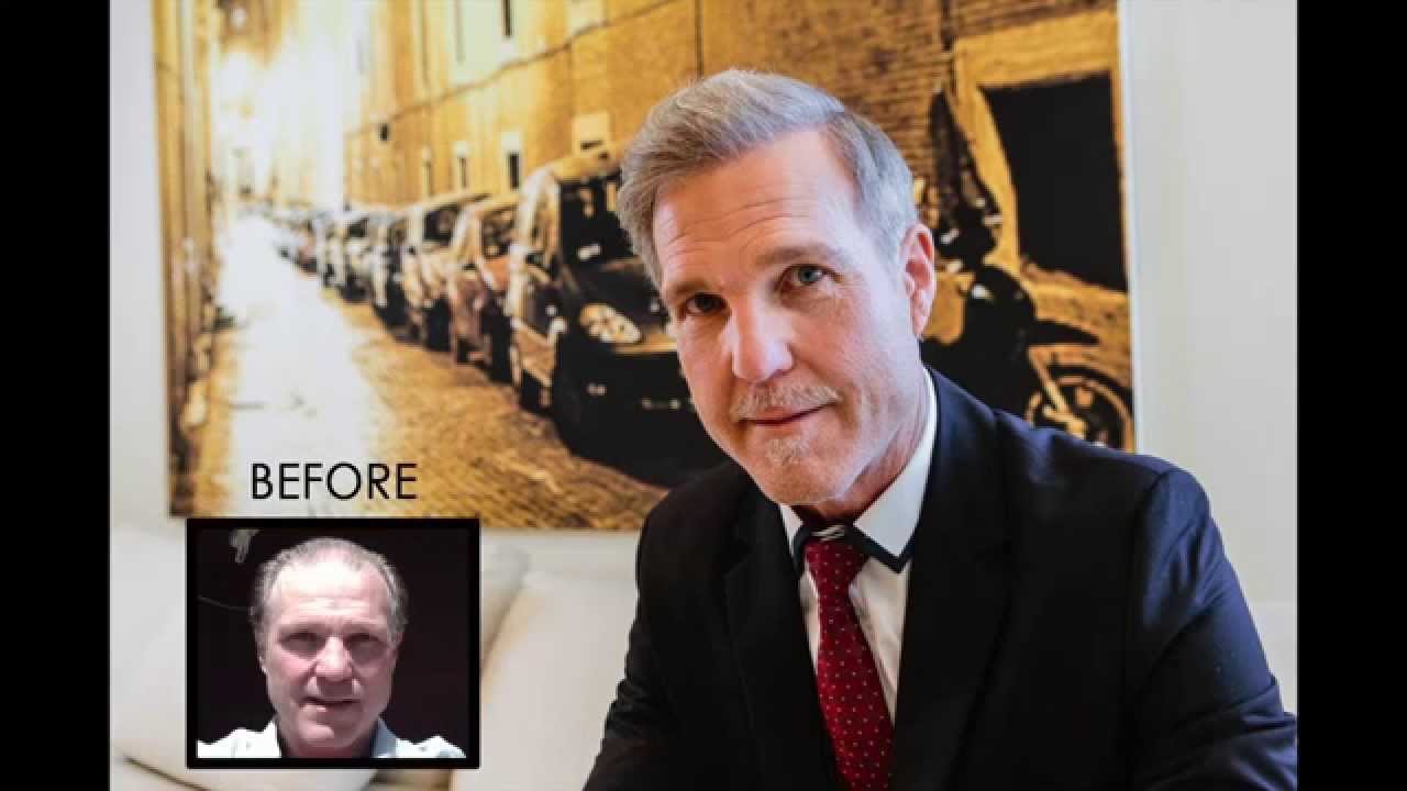 Dr. Baubac Hayatdavoudi of Alvi Armani Hair Transplant Surgery