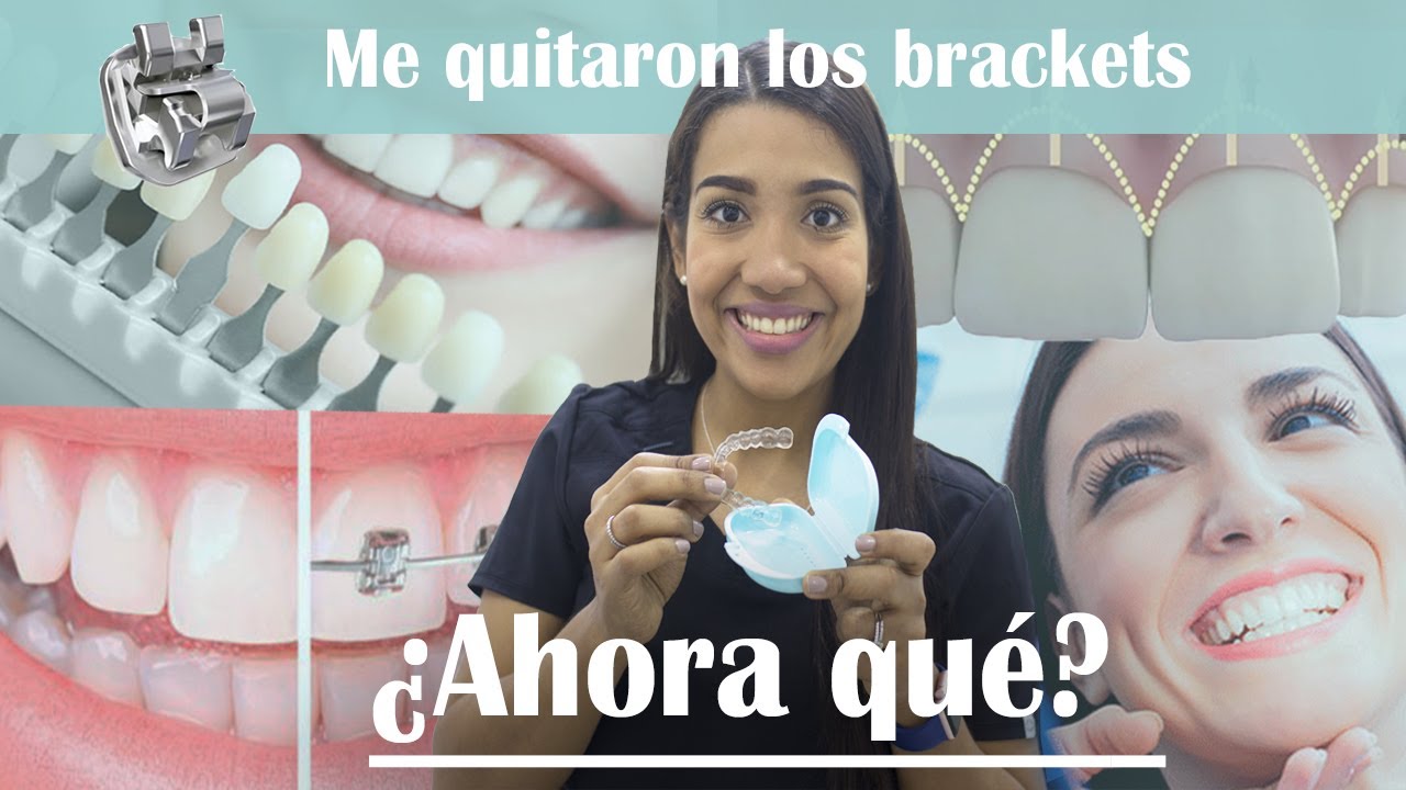Me quitaron los Brackets &iquest;Ahora qu&eacute; sigue?