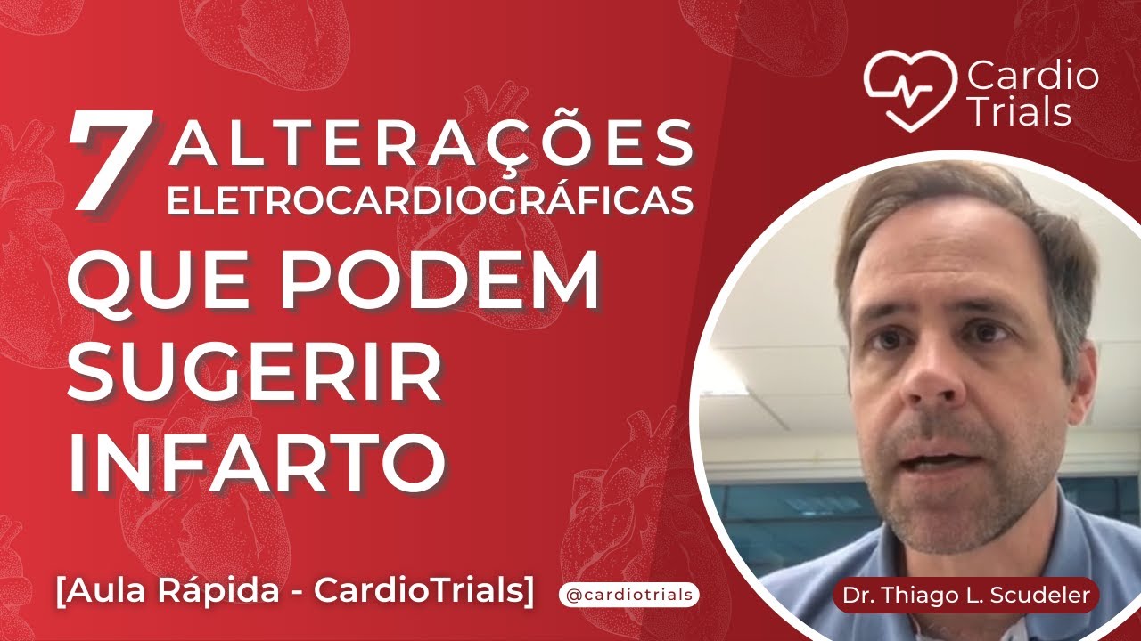 7 alterações do ECG que sugerem IAM [EXPLICAÇÃO]