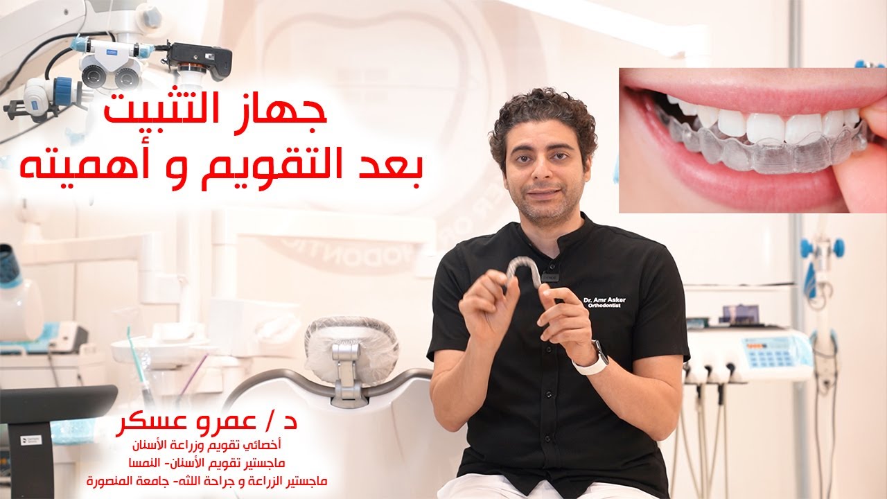 التثبيت بعد التقويم الأسنان ،أنواعه و أهميته