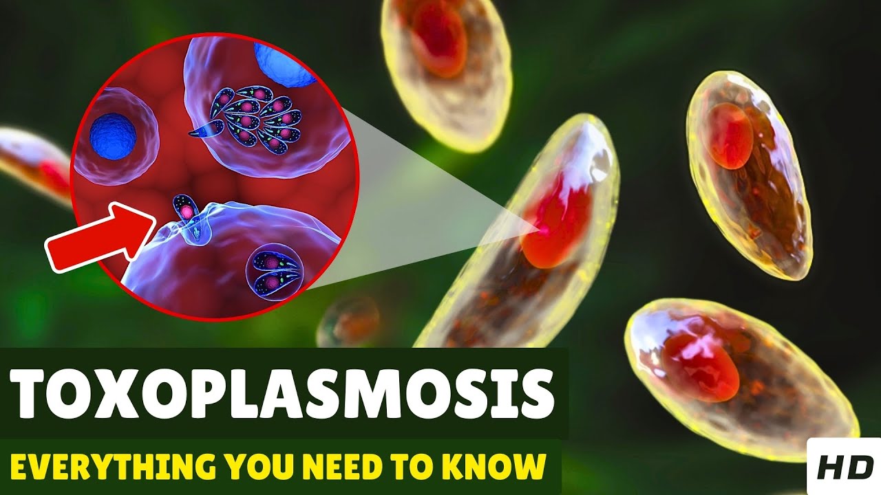 Toxoplasmosis &ndash; Causes, Signs and Symptoms, Diagnosis & Treatment