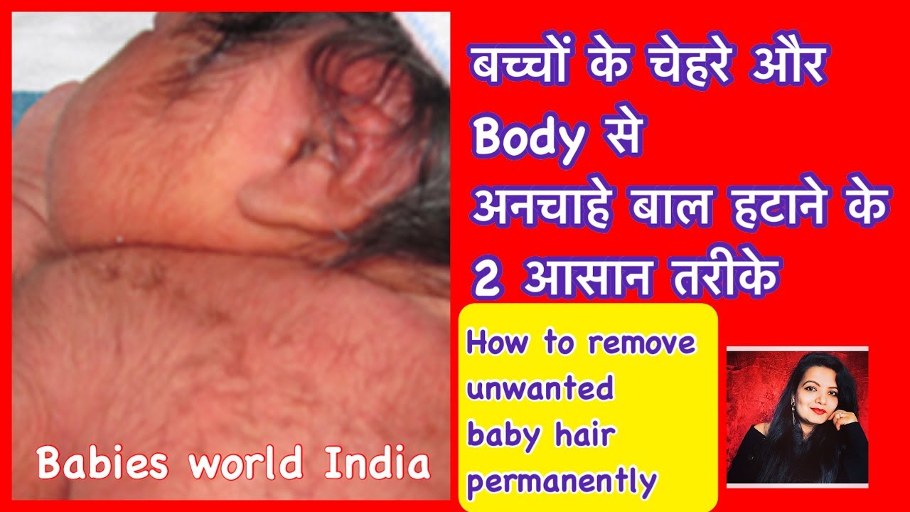 बच्चों के चेहरे के बाल हटाने के 2 आसान तरीका | How to Remove Unwanted Baby Body Hair