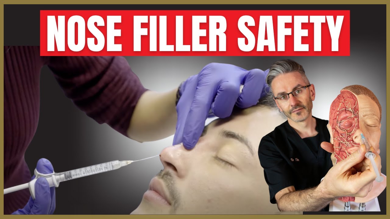 Nose Filler Safety | Liquid Rhinoplasty Injection Safety Advice