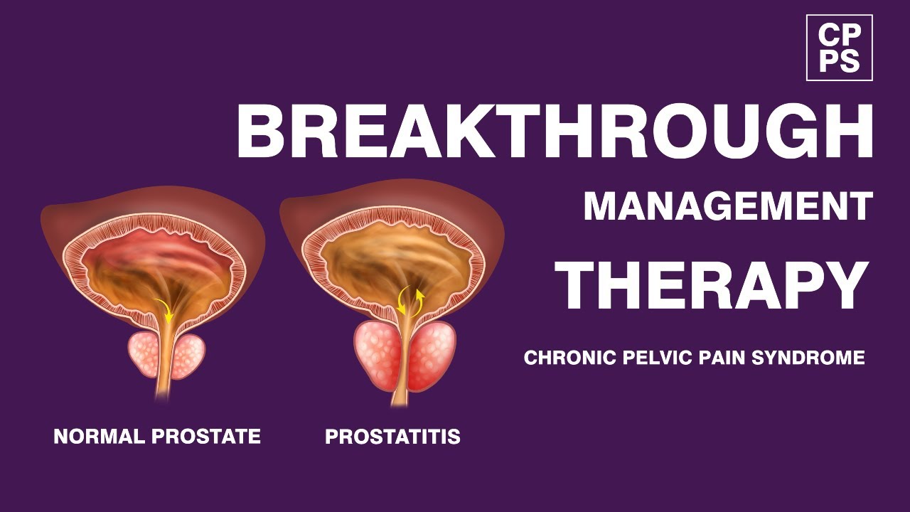 Prostatitis Treatment: Male Chronic Pelvic Pain Syndrome Shockwave Treatment